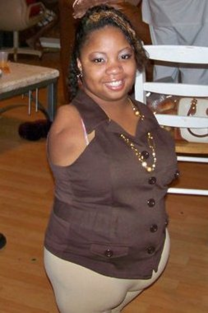 The all-conquering power of love: a girl without arms and legs marries a completely healthy man The all-conquering power of love: a girl without arms and legs marries a completely healthy man