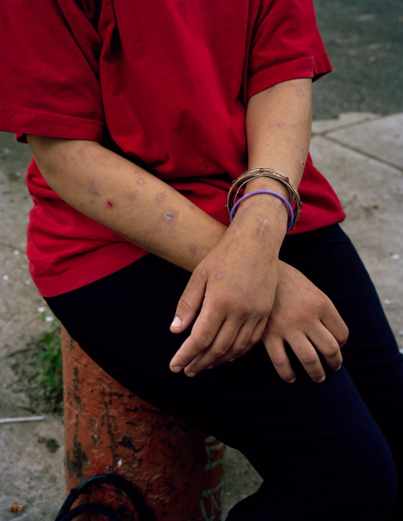 The American epidemic of drug addiction in the portraits of Jeffrey Stockbridge