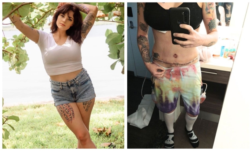 The American woman had her breasts enlarged, had a lift and pumped up her lips instead of reducing her bust The American woman had her breasts enlarged, had a lift and pumped up her lips instead of reducing her bust