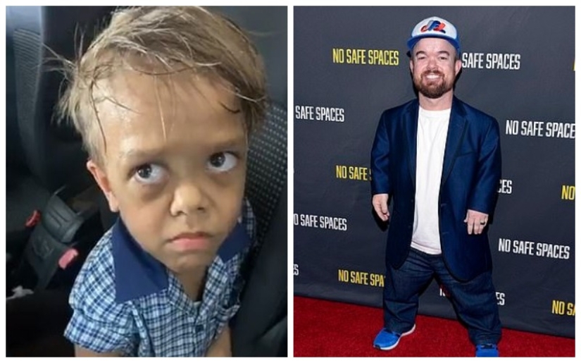 The big heart of a little man: an American comedian raised $ 200,000 to help a dwarf boy The big heart of a little man: an American comedian raised $ 200,000 to help a dwarf boy
