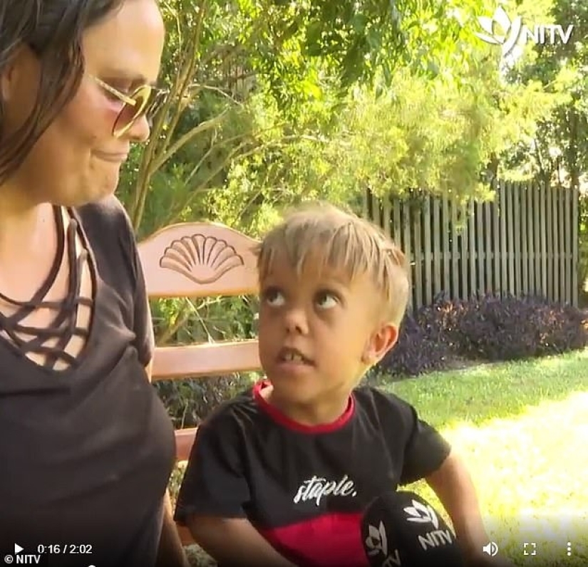 The big heart of a little man: an American comedian raised $ 200,000 to help a dwarf boy The big heart of a little man: an American comedian raised $ 200,000 to help a dwarf boy