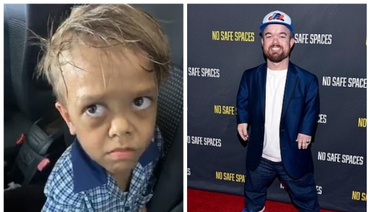 The big heart of a little man: an American comedian raised $ 200,000 to help a dwarf boy The big heart of a little man: an American comedian raised $ 200,000 to help a dwarf boy