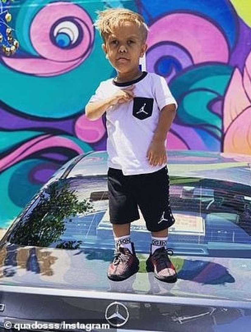 The big heart of a little man: an American comedian raised $ 200,000 to help a dwarf boy The big heart of a little man: an American comedian raised $ 200,000 to help a dwarf boy