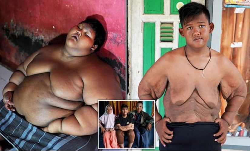 The fattest boy in the world, who weighed 192 kg at the age of 10, lost more than twice as much weight