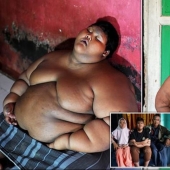 The fattest boy in the world, who weighed 192 kg at the age of 10, lost more than twice as much weight