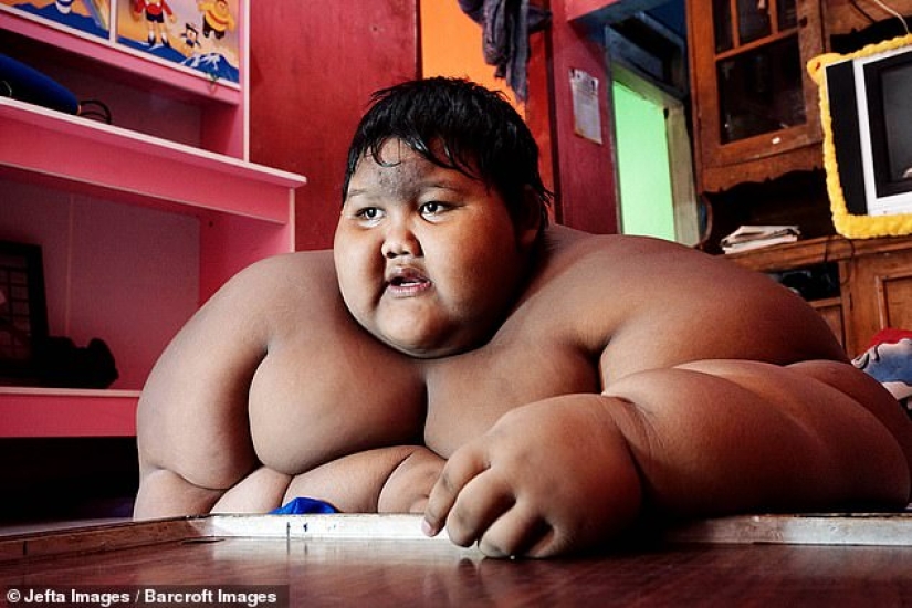 The fattest boy in the world, who weighed 192 kg at the age of 10, lost more than twice as much weight