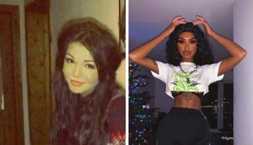 The girl, obsessed with tan, turned into a dark-skinned one. All thanks to the solarium and injections