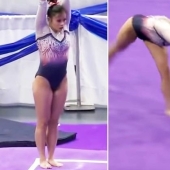 The gymnast broke both legs and admitted that she is now "really happy"