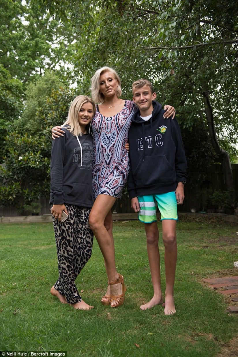 The mother of two children declared that she is the owner of the longest legs in the world The mother of two children declared that she is the owner of the longest legs in the world