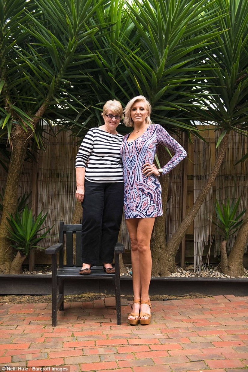 The mother of two children declared that she is the owner of the longest legs in the world The mother of two children declared that she is the owner of the longest legs in the world