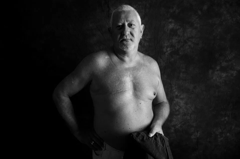The Naked Truth: Brave patients confront cancer by showing off scars in Ami Barwell's poignant photo project The Naked Truth: Brave patients confront cancer by showing off scars in Ami Barwell's poignant photo project