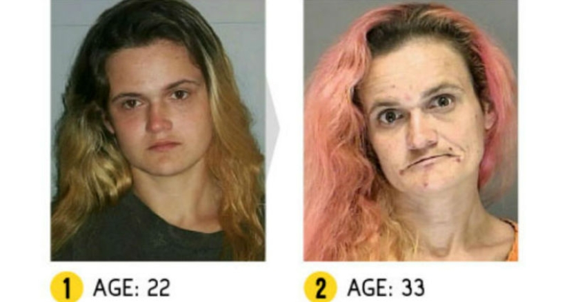 The result is obvious — how a person's appearance changes because of drugs The result is obvious — how a person's appearance changes because of drugs