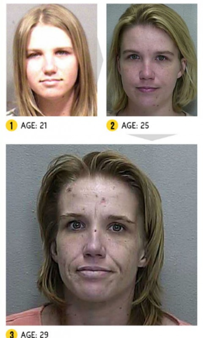 The result is obvious — how a person's appearance changes because of drugs The result is obvious — how a person's appearance changes because of drugs