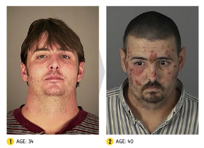 The result is obvious — how a person's appearance changes because of drugs The result is obvious — how a person's appearance changes because of drugs