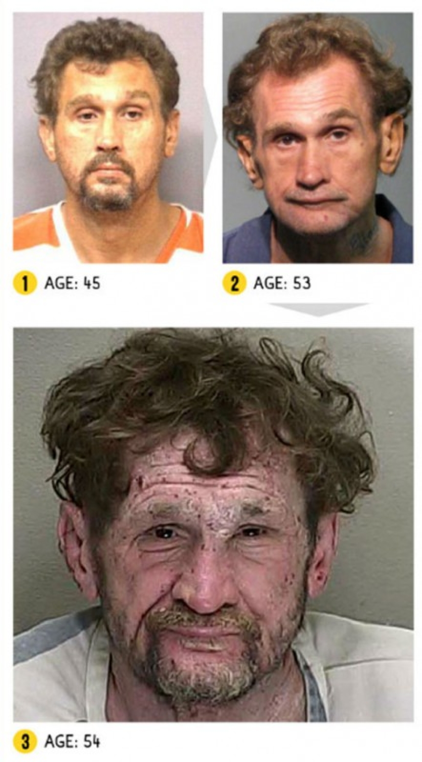 The result is obvious — how a person's appearance changes because of drugs The result is obvious — how a person's appearance changes because of drugs
