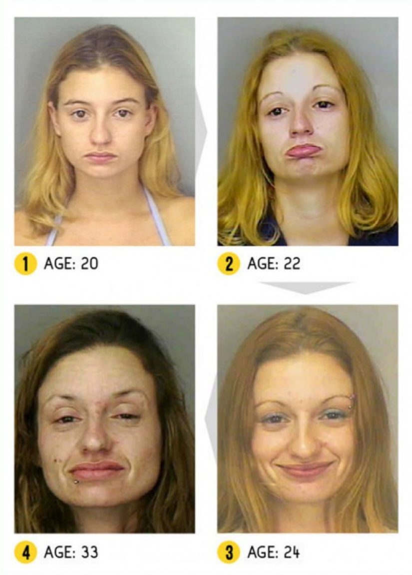 The result is obvious — how a person's appearance changes because of drugs The result is obvious — how a person's appearance changes because of drugs