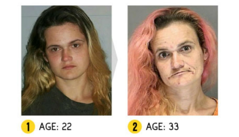 The result is obvious — how a person's appearance changes because of drugs The result is obvious — how a person's appearance changes because of drugs