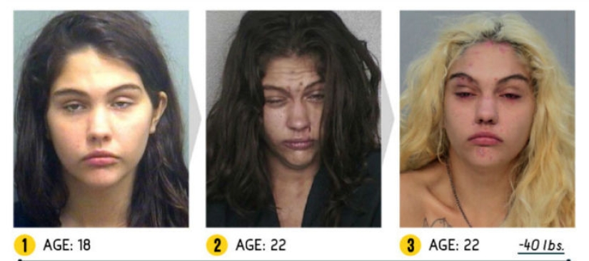 The result is obvious — how a person's appearance changes because of drugs The result is obvious — how a person's appearance changes because of drugs