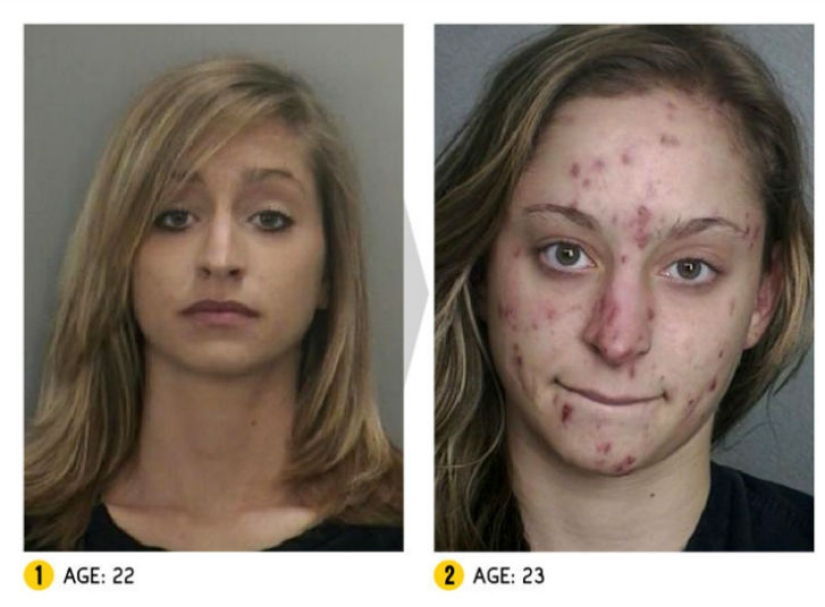 The result is obvious — how a person's appearance changes because of drugs The result is obvious — how a person's appearance changes because of drugs