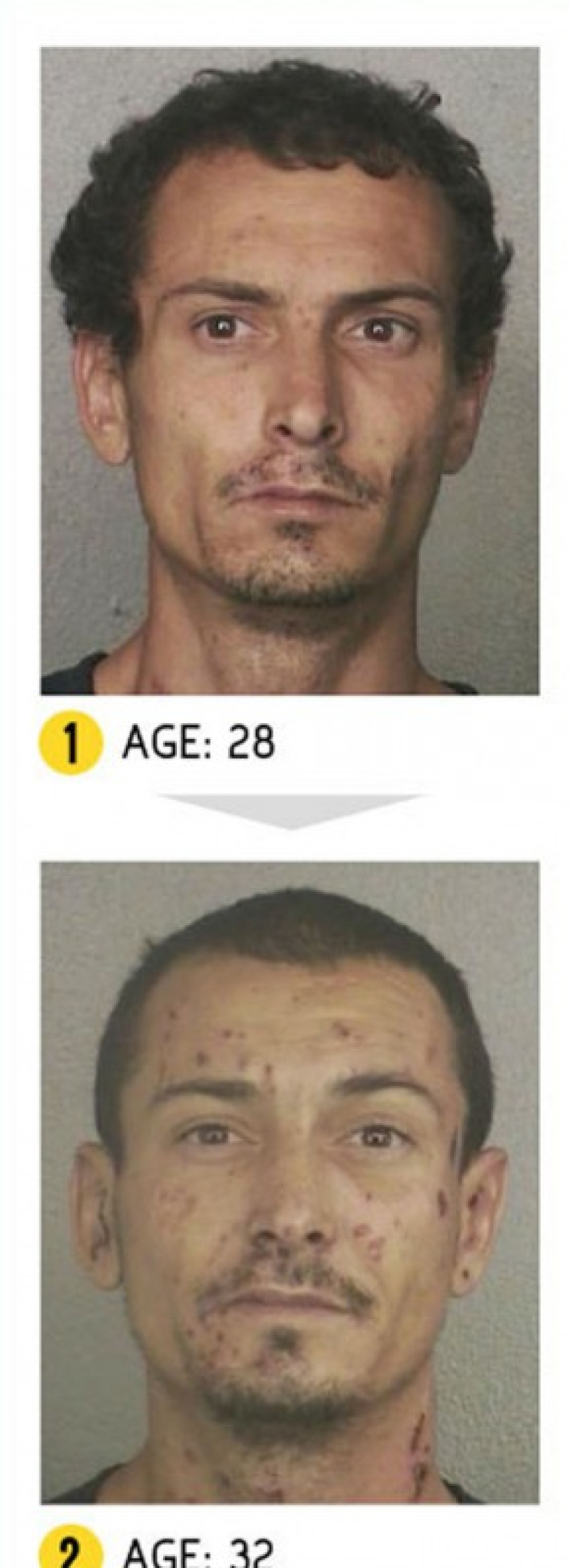 The result is obvious — how a person's appearance changes because of drugs The result is obvious — how a person's appearance changes because of drugs