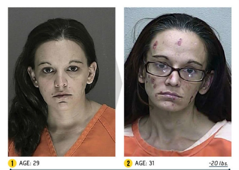 The result is obvious — how a person's appearance changes because of drugs The result is obvious — how a person's appearance changes because of drugs