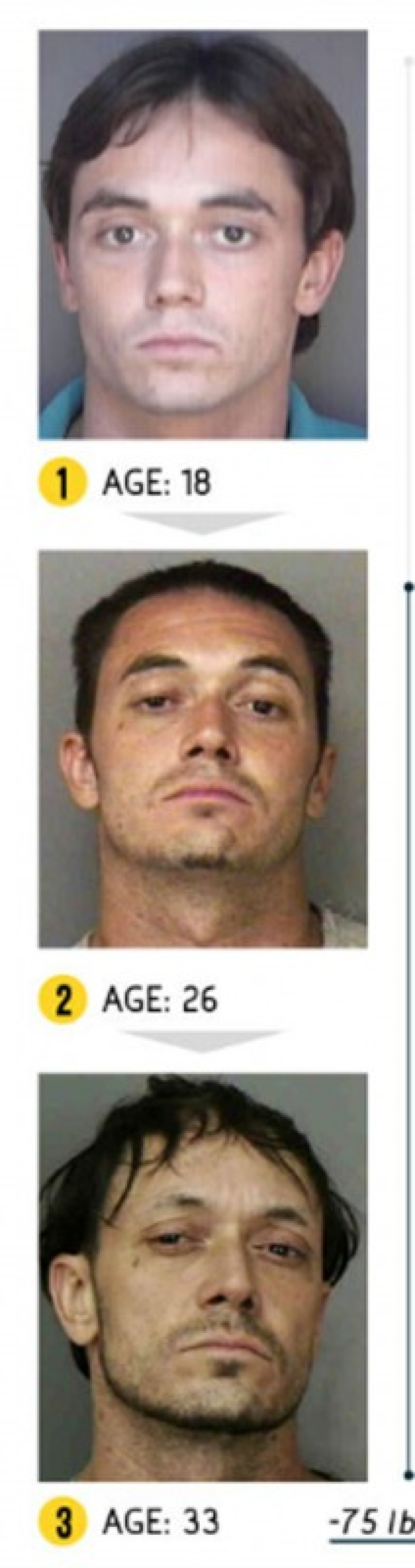 The result is obvious — how a person's appearance changes because of drugs The result is obvious — how a person's appearance changes because of drugs