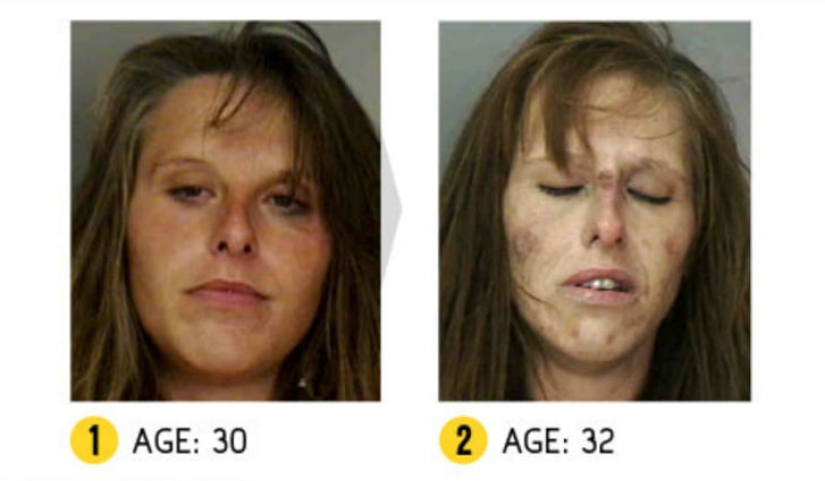 The result is obvious — how a person's appearance changes because of drugs The result is obvious — how a person's appearance changes because of drugs