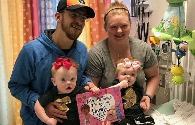 The right to life: 1.5-year-old Siamese twins, born with fused heads, recovered after a complicated operation and rejoice every day