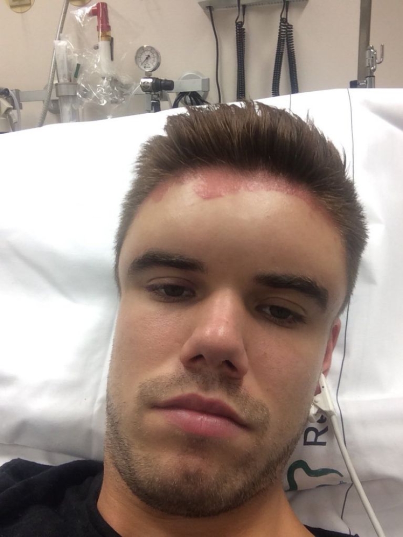 The Swede dyed his hair and turned into Frankenstein