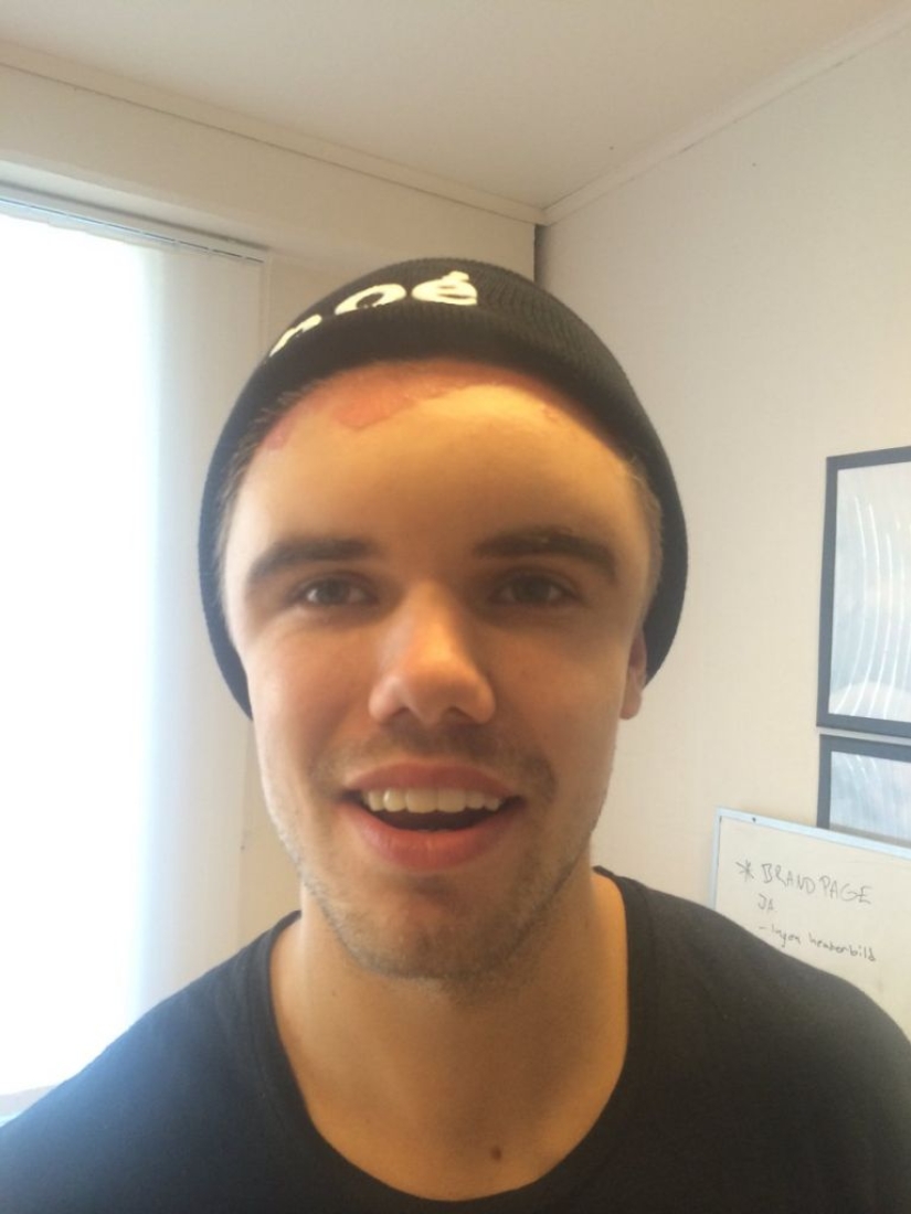 The Swede dyed his hair and turned into Frankenstein