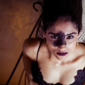 Todos se burlaron de esta chica por su marca de nacimiento, y ella tomó y se convirtió en modelo