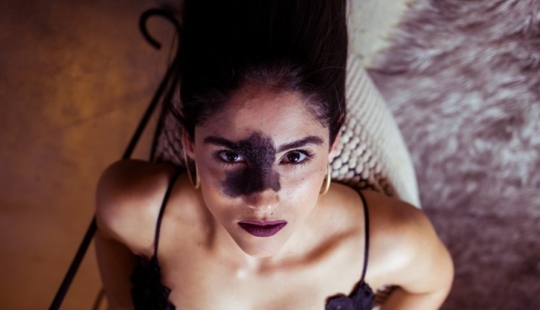 Todos se burlaron de esta chica por su marca de nacimiento, y ella tomó y se convirtió en modelo Todos se burlaron de esta chica por su marca de nacimiento, y ella tomó y se convirtió en modelo