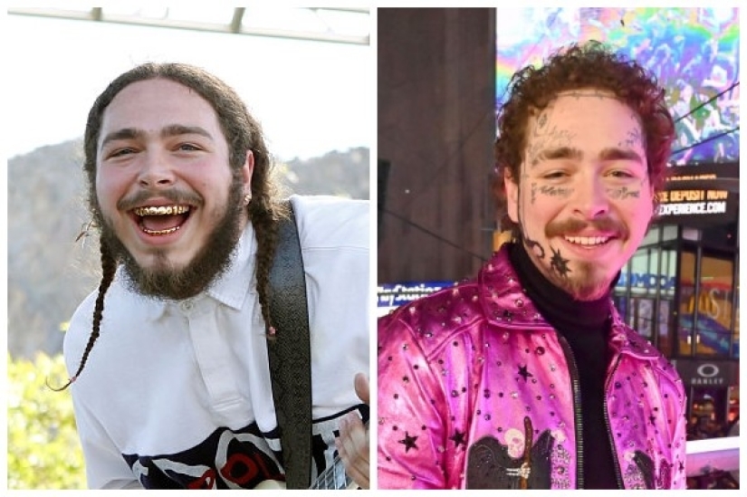 TOP 5 celebrities who disfigured their face with tattoos