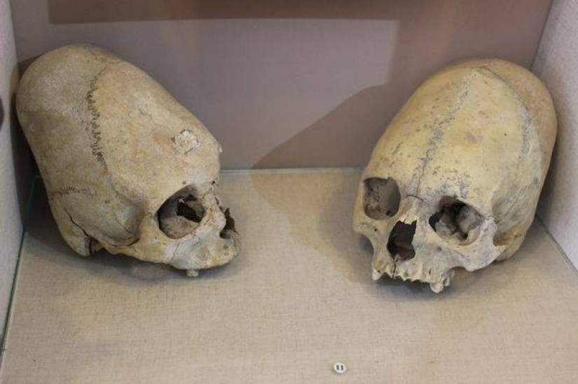 Un esqueleto de un bebé del siglo II con un cráneo alargado fue encontrado en Crimea Un esqueleto de un bebé del siglo II con un cráneo alargado fue encontrado en Crimea