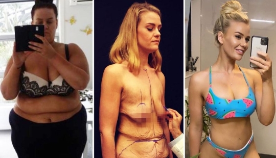 Un nuevo cuerpo es una nueva vida: la niña ha cambiado más allá del reconocimiento, habiendo perdido 90 kg