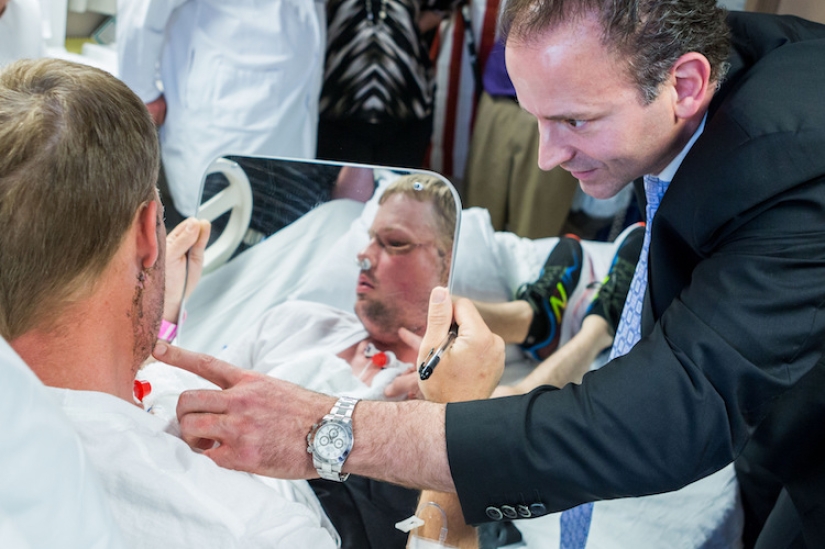 Un suicidio fallido le trasplantó la cara y comenzó una nueva vida para él