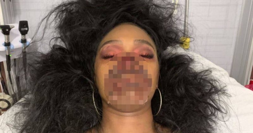 Una chica con maquillaje zombie realista engañó a los médicos