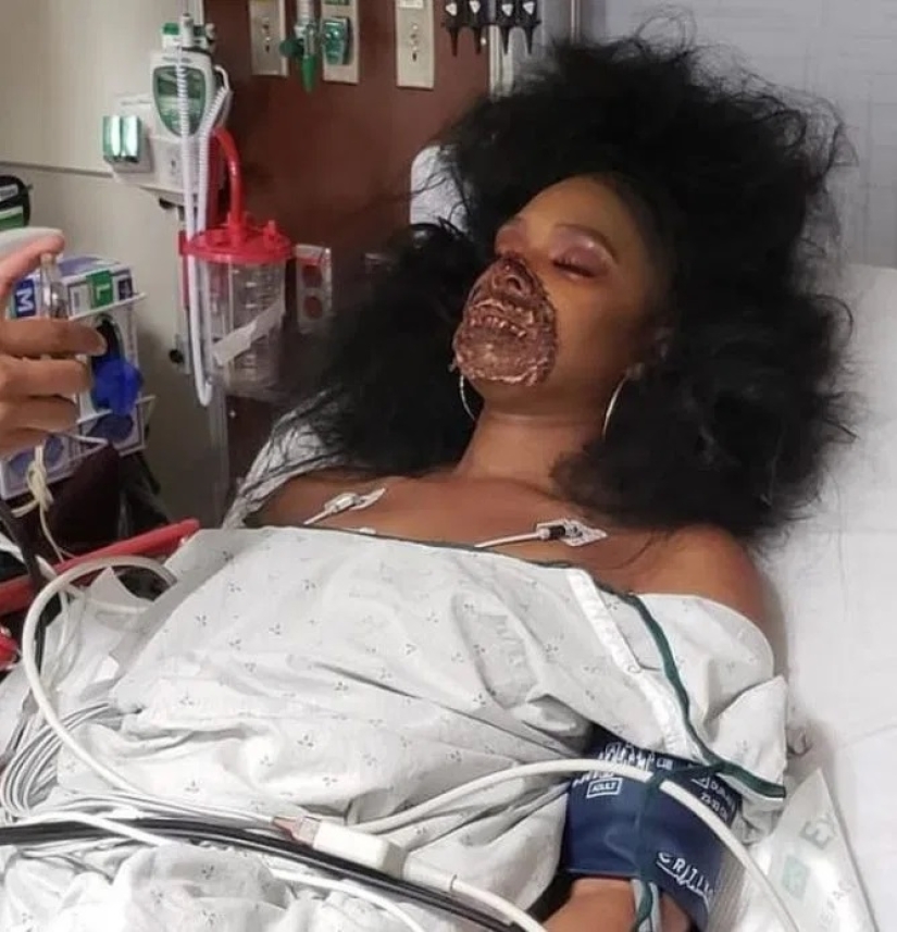 Una chica con maquillaje zombie realista engañó a los médicos
