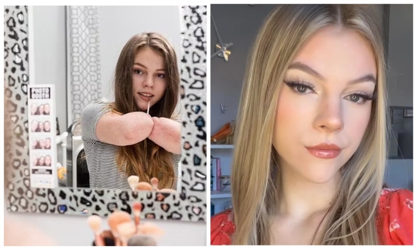 Una mujer británica a la que le amputaron todas sus extremidades lleva a cabo talleres de maquillaje