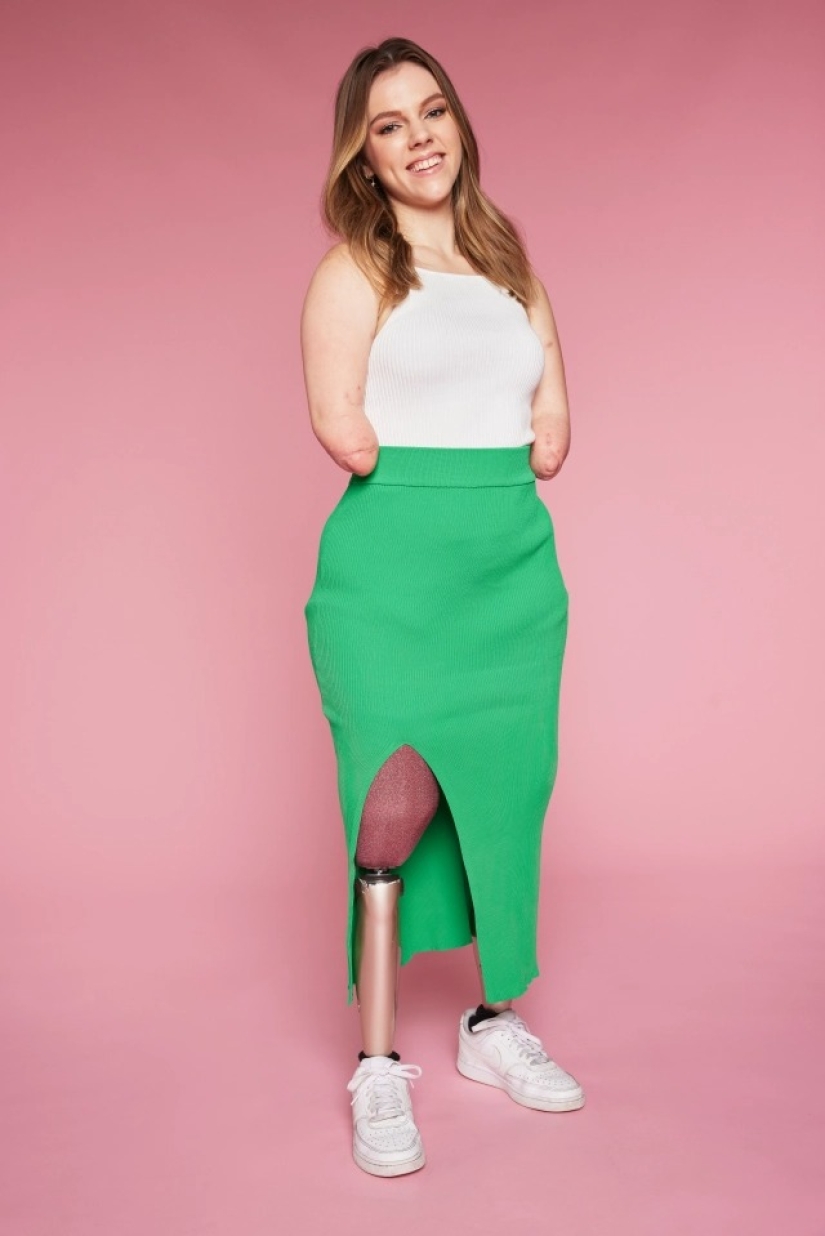 Una mujer británica a la que le amputaron todas sus extremidades lleva a cabo talleres de maquillaje