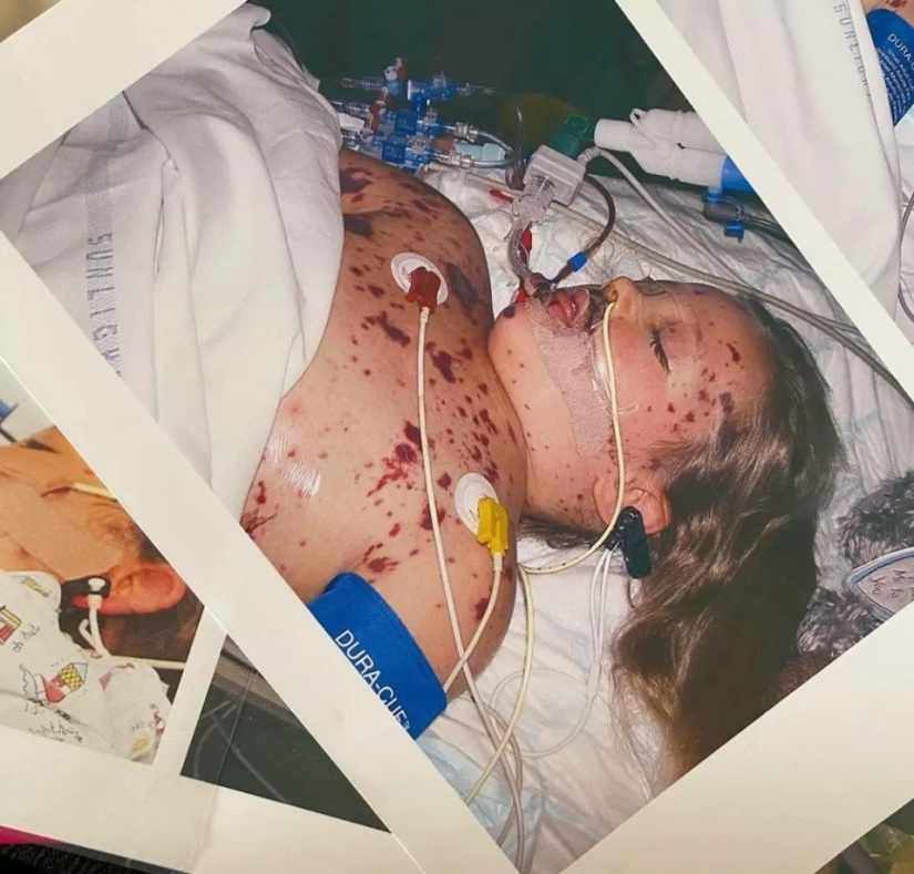 Una mujer británica a la que le amputaron todas sus extremidades lleva a cabo talleres de maquillaje