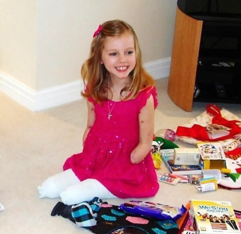 Una mujer británica a la que le amputaron todas sus extremidades lleva a cabo talleres de maquillaje