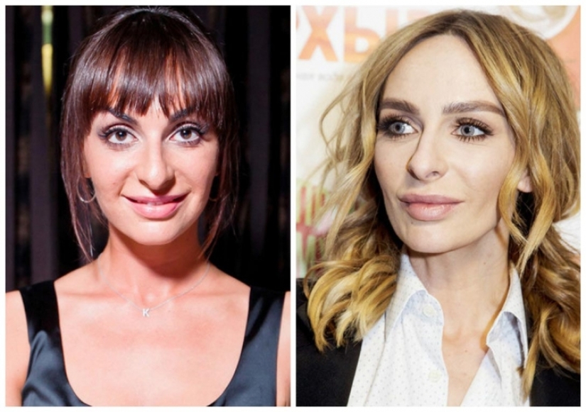 What did the primates of Russian show business look like before they made plastic surgery What did the primates of Russian show business look like before they made plastic surgery