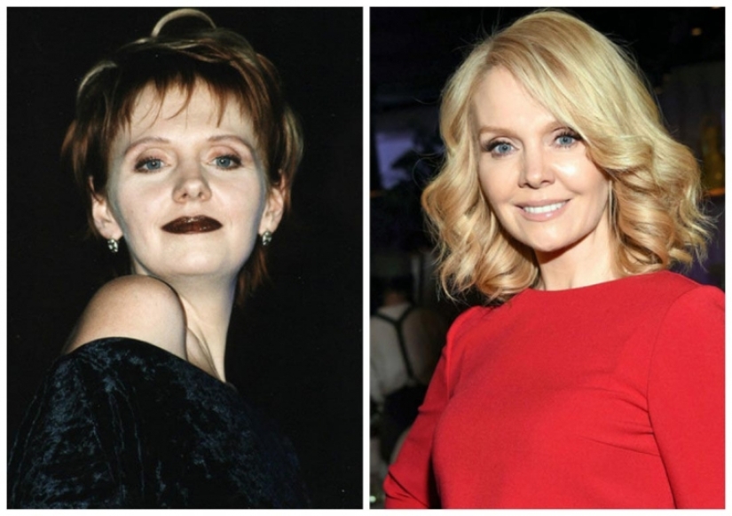 What did the primates of Russian show business look like before they made plastic surgery What did the primates of Russian show business look like before they made plastic surgery