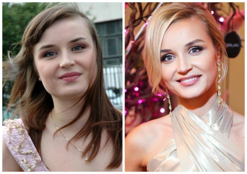 What did the primates of Russian show business look like before they made plastic surgery What did the primates of Russian show business look like before they made plastic surgery