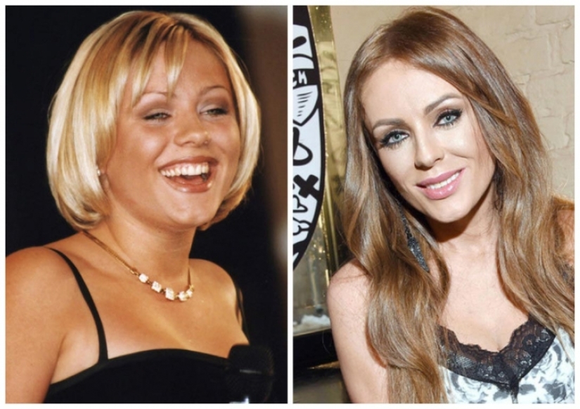What did the primates of Russian show business look like before they made plastic surgery What did the primates of Russian show business look like before they made plastic surgery