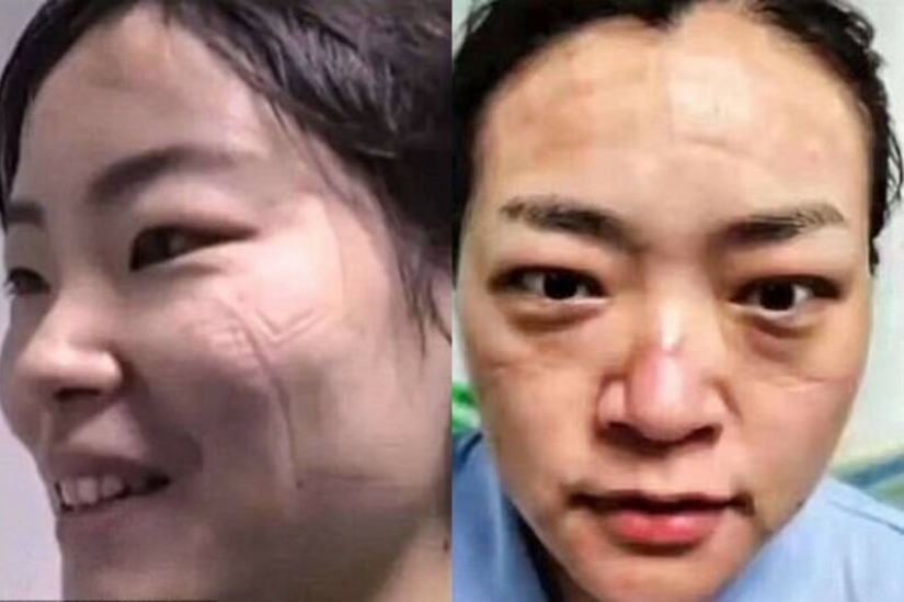 What do the faces of Chinese doctors look like at the end of a work shift