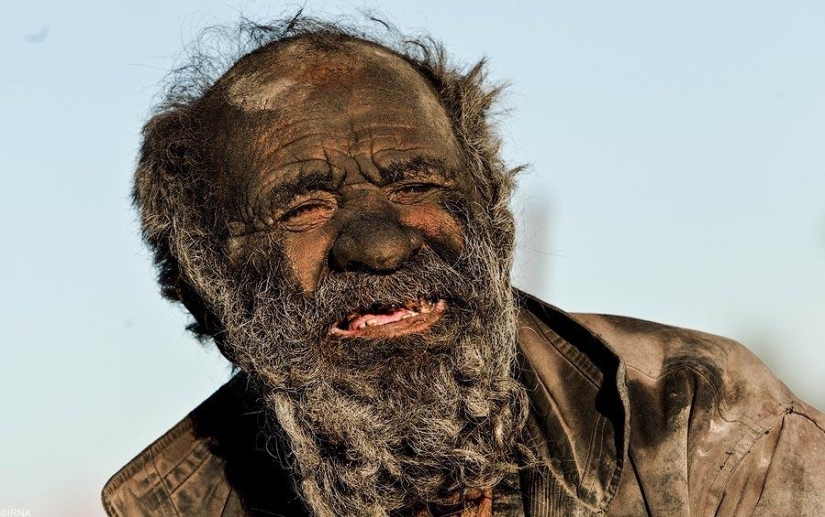 What does a person who has not washed for 60 years look like What does a person who has not washed for 60 years look like
