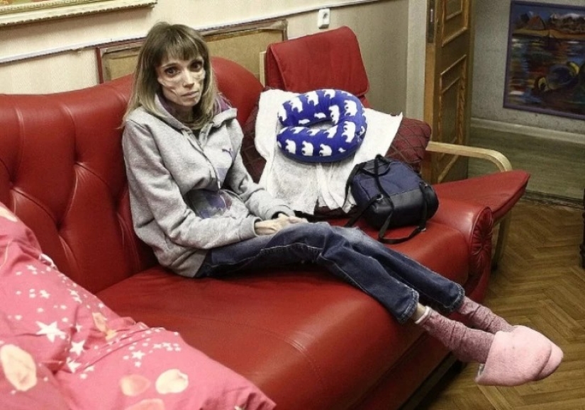 What does Kristina Koryagina look like now — a Russian woman who weighed 17 kg