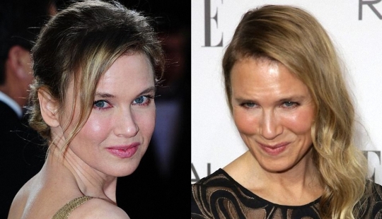 What happened to René Zellweger?
